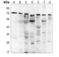 Rabbit Polyclonal Antibody to NEURL