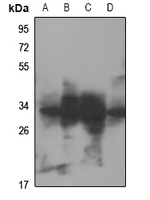 Rabbit Polyclonal Antibody to RNF144A