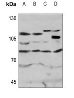 Rabbit Polyclonal Antibody to MPHOSPH10