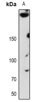 Rabbit Polyclonal Antibody to ABCA7