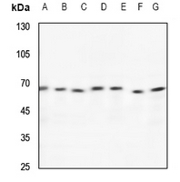 Rabbit Polyclonal Antibody to CCT8