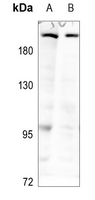 Rabbit Polyclonal Antibody to MAST2