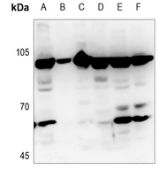 Rabbit Polyclonal Antibody to MAPK8IP2