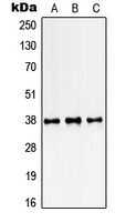 Rabbit Polyclonal Antibody to SSBP2