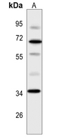 Rabbit Polyclonal Antibody to OPTC
