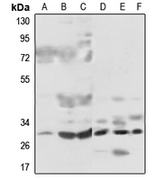 Rabbit Polyclonal Antibody to MRPL46
