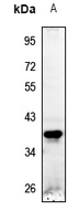 Rabbit Polyclonal Antibody to STEAP1