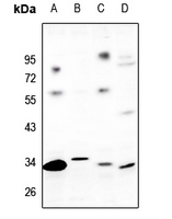 Rabbit Polyclonal Antibody to GPR82