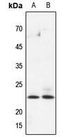 Rabbit Polyclonal Antibody to HPGDS