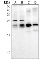 Rabbit Polyclonal Antibody to RAB30