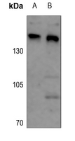 Rabbit Polyclonal Antibody to ARID4B