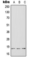 Rabbit Polyclonal Antibody to HES2