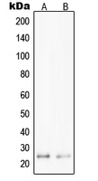 Rabbit Polyclonal Antibody to PPP1R14D