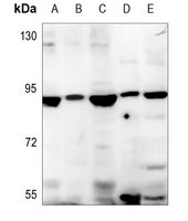 Rabbit Polyclonal Antibody to SLC6A15