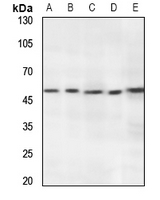 Rabbit Polyclonal Antibody to RNF130