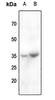 Rabbit Polyclonal Antibody to CABP4