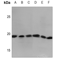 Rabbit Polyclonal Antibody to MYL7