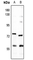 Rabbit Polyclonal Antibody to DCLRE1B