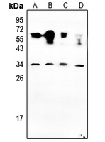 Rabbit Polyclonal Antibody to NRSN2