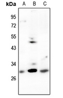 Rabbit Polyclonal Antibody to CDCA3
