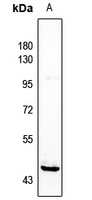Rabbit Polyclonal Antibody to HORMAD1