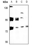 Rabbit Polyclonal Antibody to ARHGAP18