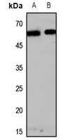 Rabbit Polyclonal Antibody to OPN4
