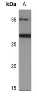 Rabbit Polyclonal Antibody to BATF2