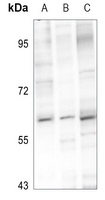 Rabbit Polyclonal Antibody to PIGW