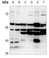 Rabbit Polyclonal Antibody to EMR4P