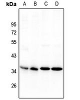 Rabbit Polyclonal Antibody to NANOGP8