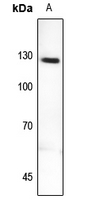 Rabbit Polyclonal Antibody to MYBPC2