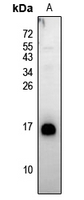 Rabbit Polyclonal Antibody to NMB