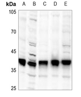 Rabbit Polyclonal Antibody to PLSCR1