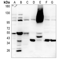 Rabbit Polyclonal Antibody to RBBP6