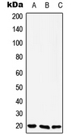 Rabbit Polyclonal Antibody to YAF2