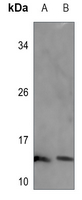 Rabbit Polyclonal Antibody to SEC61B