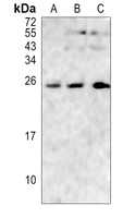 Rabbit Polyclonal Antibody to RGS17