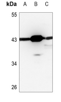 Rabbit Polyclonal Antibody to PSKH2