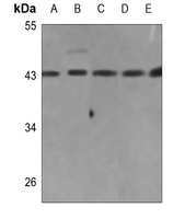 Rabbit Polyclonal Antibody to EMID2
