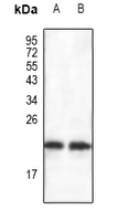 Rabbit Polyclonal Antibody to BAX