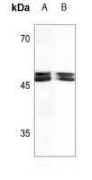Rabbit Polyclonal Antibody to TDG