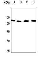 Rabbit Polyclonal Antibody to PALLD
