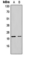 Rabbit Polyclonal Antibody to MRPL17