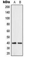 Rabbit Polyclonal Antibody to ABHD12B