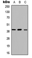 Rabbit Polyclonal Antibody to ABHD13