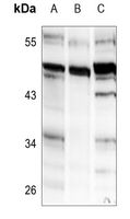 Rabbit Polyclonal Antibody to COLQ