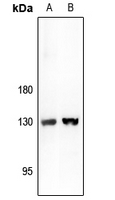 Rabbit Polyclonal Antibody to ARHGAP20