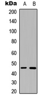 Rabbit Polyclonal Antibody to B4GALT6