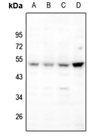 Rabbit Polyclonal Antibody to BAMBI